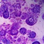 Mastocytome cyto